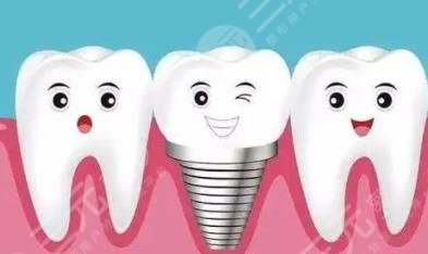 牙齒種植