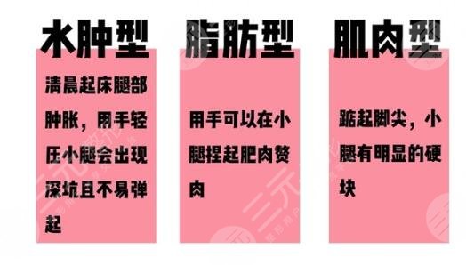 抽脂改良肌肉小腿有哪些注意事項？