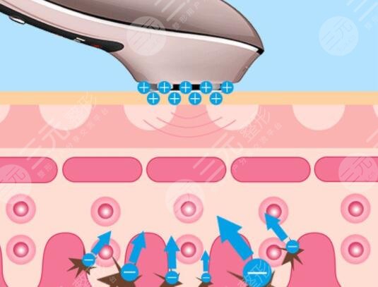 彩光超音波美容儀有用嗎?