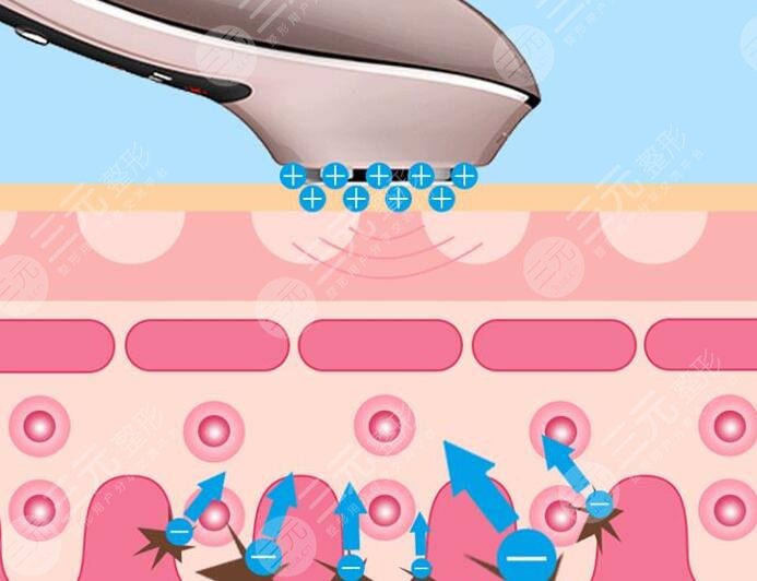 彩光超音波美容儀的作用原理是什么?