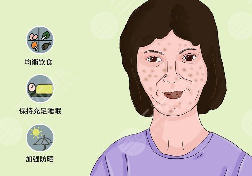簡單美白祛斑的方法有哪些？