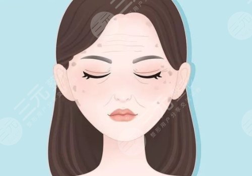 怎樣治老年斑？