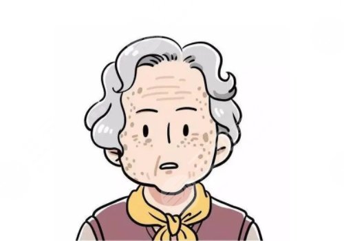 怎樣治老年斑？