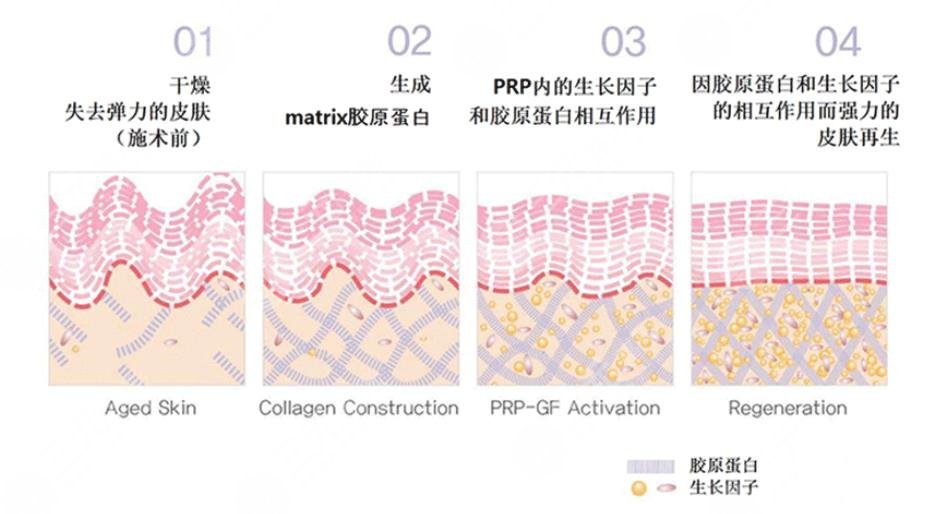 哪種膠原蛋白好?