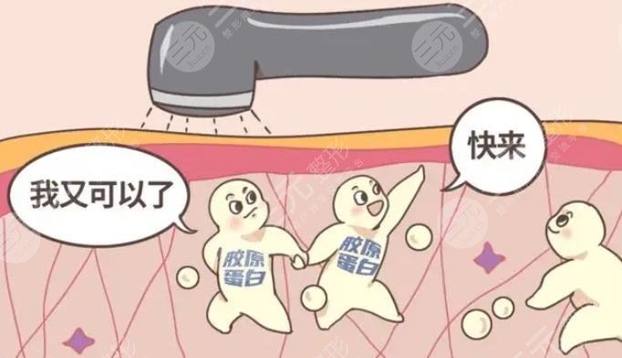 哪種膠原蛋白好?