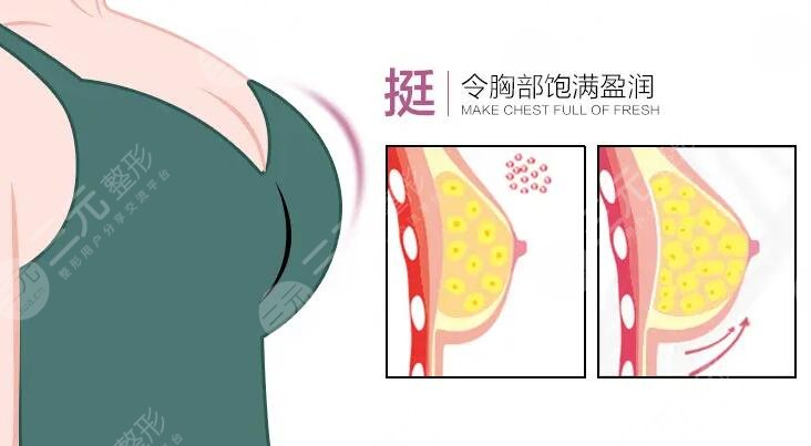 自體脂肪隆胸手術