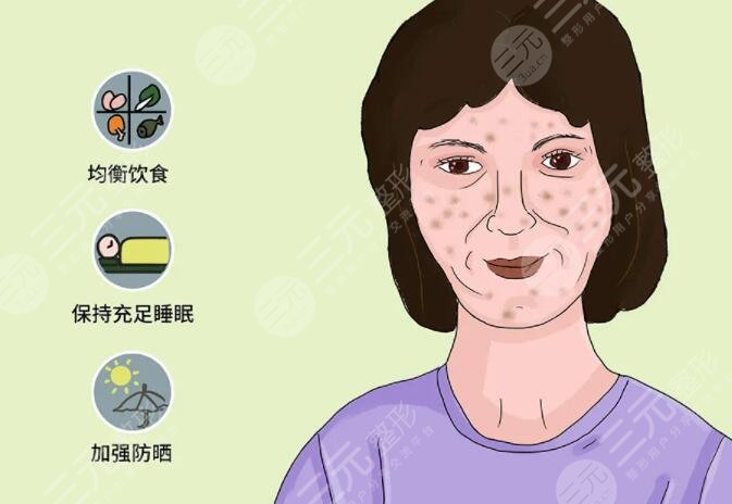 激光祛斑的優(yōu)勢