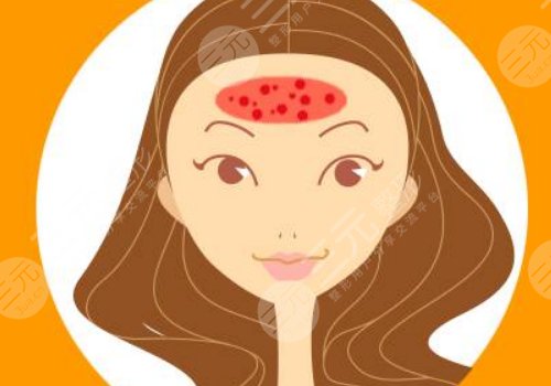 額頭長(zhǎng)了很多密密麻麻的小痘痘是什么原因？