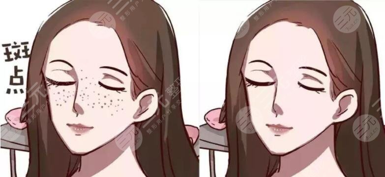 皮膚上的色斑是如何形成的?