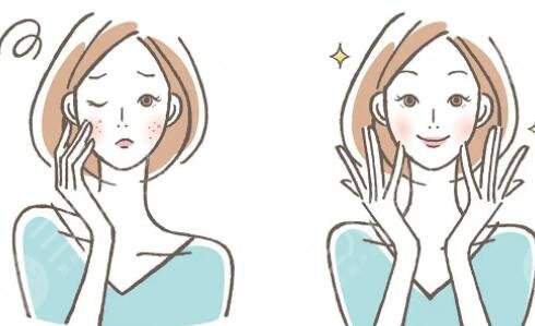 市面上常見(jiàn)祛斑方法