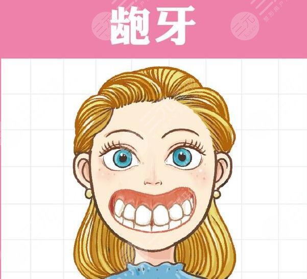　　美容冠矯正齙牙果嗎?其實這種緩解能夠讓口腔狀態(tài)更加地正常和協(xié)調(diào)，而且也能夠讓牙齒排列的，更加的精美。通過做齙牙的矯正緩解，能夠讓整個人的口腔狀態(tài)看上去更加的自然和協(xié)調(diào)，但是想要通過做美容冠來解決自己的齙牙，這種做法是不推薦的，雖然能夠達到一定的果，但是治標不治本，而且，這種緩解方式，并不適用于所有的齙牙。那么，美容冠矯正齙牙果如何?  　　一、美容冠矯正齙牙果嗎?  　　一般情況下，如果齙牙的程度比較輕的話，那么通過做美容冠緩解能夠達到一定的果，但是嚴重的齙牙，做美容冠其實是沒有作用的，不能夠達到齙牙的緩解果。有些輕度的齙牙，做美容冠是有代價的，而且需要在專業(yè)醫(yī)生的指導下磨出一部分牙齒組織，讓牙齒變得更小，然后重新套一個冠下去，并且，套一個可能沒那么齙的固定冠下去，所以說這種方式有一定的局限性，而且是不值得推薦的。  　　二、齙牙如何緩解?  　　齙牙的緩解方式主要分為拔牙和牙齒矯正，尤其是隱形正畸手術或金屬正畸手術。有齙牙的患者，建議去做正畸緩解，通過做該緩解，能夠讓牙齒排列的更加的正?；蛘呷绻麌乐兀€可以去專業(yè)的醫(yī)院完成正頜外科方面的手術，包括聯(lián)合箍牙、矯牙的緩解來進行矯正。  　　1、做拔牙緩解。其實拔牙緩解能夠讓整個人的口腔狀態(tài)看上去更加的美觀，而且拔出了大多數(shù)的牙齒之后，整個人的口腔狀態(tài)也會更加的協(xié)調(diào)齙牙的存在，也能夠得到更好的改良。  　　2、做牙齒矯正手術。做牙齒矯正手術，包括隱形正畸手術和金屬正畸手術，而且需要佩戴牙套，再佩戴了牙套之后牙齒才會排列的，更加的整齊和美觀。一般分為隱形的牙套和金屬的牙套，隱形的牙套是可以自行摘戴的，而且美觀都是相對較好的，雖然金屬牙套不能夠自行摘戴，但是能夠起到更好的塑形果，其實也是一種不錯的操作。在佩戴牙套大概一年左右的時間再取下來，整個人的口腔狀態(tài)看上去就會更加的美觀，并且牙齒也會更加的自然和協(xié)調(diào)，一般不會出現(xiàn)劇烈的刺痛感和疼痛感，但是需要對口腔進行一定的護理。  　　3、做正頜手術。做任何手術能夠讓牙齒排列的更加的整齊，也能夠讓整個人的牙槽骨看上去更加的自然和協(xié)調(diào)，做完緩解之后牙齒是一般不會脫落的。  　　三、美容冠矯正齙牙的注意事項  　　其實，做牙齒方面的緩解一定要找專業(yè)的醫(yī)生進行操作，不能夠盲目的開展緩解。而且做完緩解之后，也要多吃新鮮的蔬菜和水果，少吃辛辣油膩以及刺激性的食物，不能夠經(jīng)常熬夜，否則可能會影響自己牙齒的恢復。同時也要注重自己日常的口腔清潔和護理，如果出現(xiàn)了牙菌斑滋生的現(xiàn)象，那么就要找醫(yī)生進行一定的緩解，不能夠經(jīng)常不刷牙，否則可能會導致牙齒細菌增多影響口腔的健康。