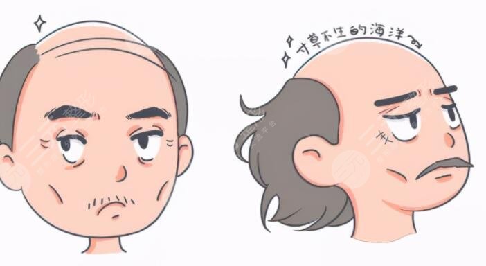 生姜能緩解脫發(fā)嗎？怎么正確使用不傷頭皮？詳細(xì)操作方法告訴你！