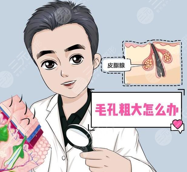 　　男性毛孔粗大怎么辦?這種方式其實(shí)是很不錯(cuò)的，而且能夠讓整個(gè)人的皮膚狀態(tài)看上去更加的美觀，能夠更好的改良毛孔粗大的問題，從而讓整個(gè)人的肌膚狀態(tài)看上去更加的精美和自然。其實(shí)很多的男性毛孔都是比較粗大的，想要更好的改良方式也是較多的，可以根據(jù)自己的皮膚狀態(tài)選擇更加適合的方式進(jìn)行緩解，也可以去專業(yè)的醫(yī)院進(jìn)行一定的咨詢，下面我們一起來了解了解男性毛孔粗大怎么辦?  　　一、男性毛孔粗大怎么辦?  　　男生毛孔粗大，可以在專業(yè)醫(yī)生的指導(dǎo)下，使用局部的外用藥物進(jìn)行改良，同時(shí)也可以采用光子嫩膚的方式進(jìn)行一定的調(diào)節(jié)。還可以使用果酸，煥膚等方式進(jìn)行一定的緩解，這幾種操作方式都并不是特別的繁瑣和復(fù)雜，能夠讓整個(gè)人的皮膚狀態(tài)看上去更加的美觀。  　　1、局部使用藥物。其實(shí)局部的使用藥物能夠讓整個(gè)人的皮膚看上去更加的年輕化和光滑，一般不會(huì)出現(xiàn)劇烈的刺痛感和疼痛感，反而能夠讓肌膚狀態(tài)看上去更加的年輕化和自然化，改良了肌膚衰老的感覺。當(dāng)男生毛孔過于粗大時(shí)，可以使用一些維a酸乳膏或者是水楊酸乳膏進(jìn)行一定的涂抹，能夠讓肌膚看上去更加的年輕化，加速角質(zhì)的排出，溶解角質(zhì)，因此能夠更好的改良毛孔粗大等方面的問題，從而讓整個(gè)人的皮膚狀態(tài)看上去更加的光滑，也能夠讓個(gè)人的氣質(zhì)得到一定的提升。  　　2、光子嫩膚。當(dāng)毛孔粗大時(shí)，可以在專業(yè)醫(yī)生的指導(dǎo)下，利用光子嫩膚產(chǎn)生的強(qiáng)脈沖光能量，因此能夠讓整個(gè)人的皮膚狀態(tài)看上去更加的年輕化，而且在處理的過程中整個(gè)人的膠原蛋白能夠得到一定的提升，纖維蛋白源也會(huì)增多，一般是不會(huì)出現(xiàn)不適癥狀的。做緩解的過程中，能達(dá)到皮膚深層組織，玩更好的抑制皮膚表面細(xì)菌繁殖，并且也能夠減少油脂分泌，因此通過做該緩解能夠縮小毛孔并且改良毛孔粗大的現(xiàn)象，讓整個(gè)人的皮膚看上去更加的光滑，也能夠讓肌膚看上去更加的年輕化，改良衰老的感覺，從而提升個(gè)人的氣質(zhì)。  　　3、果酸換膚。果酸換膚緩解，是利用高濃度的果酸對(duì)皮膚進(jìn)行剝離，通過做該緩解，不僅能夠讓皮膚狀態(tài)看上去更加的年輕化，同時(shí)還可以使老化的角質(zhì)層脫落，能夠促進(jìn)新的細(xì)胞再次生長(zhǎng)，因此采用這種方式能夠更好的美白自己的肌膚，同時(shí)也能夠讓個(gè)人的肌膚狀態(tài)看上去更加的年輕化，從而縮小毛孔。  　　二、男性收縮毛孔的注意事項(xiàng)  　　男生毛孔粗大需要做好面部的護(hù)理工作，不要在陽光下進(jìn)行暴曬，否則可能會(huì)出現(xiàn)劇烈的刺痛感和疼痛感，而且在出門的時(shí)候也要記得對(duì)肌膚進(jìn)行一定的防曬，可以適當(dāng)?shù)耐磕ǚ罆袼⑶乙部梢源蛘陉杺慊蛘呤谴┓罆褚?。想要讓自己毛孔粗大的現(xiàn)象得到更好的改良，而且對(duì)于臉部的清潔和護(hù)理是要更加的注重每天，都可以用溫水洗臉，能夠清除臉部的大部分雜質(zhì)和雜菌，同時(shí)也要注重臉部的補(bǔ)水。