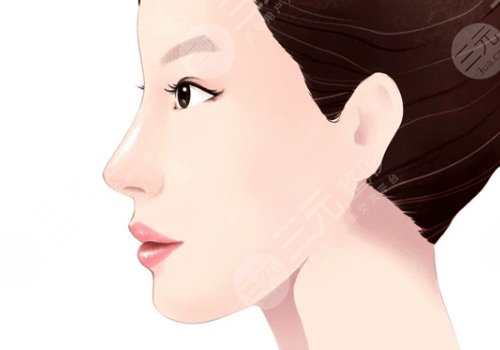 玻尿酸隆鼻會(huì)不會(huì)鼻梁越來越寬?