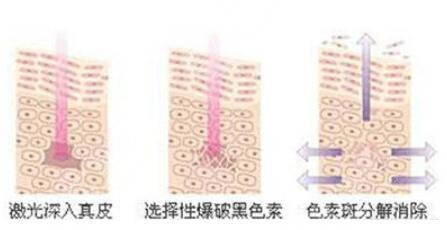 影響黑臉娃娃價(jià)格的因素