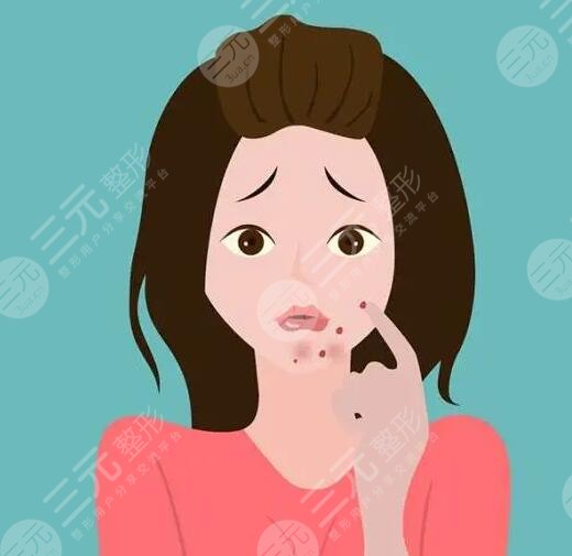 　　如何快速去青春痘?對(duì)于青春期的男生和女生們來(lái)講，大多數(shù)人都難逃青春痘的困擾，青春痘嚴(yán)重的時(shí)候會(huì)影響到一個(gè)人的顏值，所以青春期的男生和女生們大多都在戰(zhàn)“痘”，可是在緩解痘痘的時(shí)候也需要選對(duì)方法，不要盲目的去除痘痘，以免對(duì)皮膚造成傷害，下面做一個(gè)護(hù)膚達(dá)人，就來(lái)帶大家深入的認(rèn)識(shí)一下，如何快速去除青春痘?被青春痘困擾的男生女生可以詳細(xì)來(lái)了解一下。  　　1、如何快速去青春痘?  　　日常生活中快速去除青春痘的方式，常見(jiàn)的有藥物緩解、激光緩解以及紅藍(lán)光照射等，可以根據(jù)自己的皮膚狀態(tài)選擇適合自己的去除青春痘方式。  　　(1)藥物緩解  　　皮膚上的青春痘可以在專(zhuān)業(yè)醫(yī)生指導(dǎo)下，使用紅霉素軟膏或者阿達(dá)帕林凝膠進(jìn)行緩解，這些藥膏能夠快速消除青春痘。但是需要在專(zhuān)業(yè)醫(yī)生指導(dǎo)下規(guī)范用藥，不要盲目的使用，以免對(duì)皮膚造成傷害。  　　(2)激光緩解  　　激光緩解青春痘是醫(yī)療美容界的一種新型祛痘方式，激光緩解青春痘的原理，主要通過(guò)激光儀器所發(fā)出的高能熱量穿透皮膚表皮層，直接作用在皮膚基底層，這種熱量能夠促進(jìn)皮膚深層細(xì)胞組織生長(zhǎng)，從而可以讓皮膚上的青春痘逐漸修復(fù)，可以讓皮膚恢復(fù)到光滑平整的目的。  　　(3)紅藍(lán)光照射  　　紅藍(lán)光照射緩解青春痘，主要采用專(zhuān)業(yè)儀器發(fā)出的紅光熱效應(yīng)和藍(lán)光熱效應(yīng)對(duì)皮膚進(jìn)行交替照射，緩解皮膚上青春痘的同時(shí)還可以消除皮膚上的炎癥，是緩解青春痘的一種不錯(cuò)的方式。  　　2、青春痘是怎樣形成的?  　　青春痘大多是因?yàn)槊移ぶ傺装Y性病變導(dǎo)致的，因?yàn)樯眢w的內(nèi)分泌失調(diào)，導(dǎo)致雄激素水平偏高，從而誘發(fā)皮脂腺分泌增多，同時(shí)毛孔角化排出也不夠順暢，從而就形成了脂肪酸，繼發(fā)細(xì)菌感染的時(shí)候就會(huì)形成青春痘。另外在日常生活中長(zhǎng)時(shí)間喝酒，或者總是吃一些高脂肪飲食，或者是日常生活中總是長(zhǎng)時(shí)間熬夜也會(huì)導(dǎo)致青春痘生長(zhǎng)。需要注意的是青春痘并不一定是發(fā)生在青春期的，通常現(xiàn)在大多數(shù)人因?yàn)樯罟?jié)奏加快，成年人長(zhǎng)青春痘也不少見(jiàn)，并且比青春期長(zhǎng)的青春痘要比較頑固和復(fù)雜。  　　3、怎樣防止青春痘?  　　想要防止青春痘，在日常生活中要養(yǎng)成良好的飲食習(xí)慣和規(guī)律作息，平時(shí)飲食盡量少吃吃熱量比較高和脂肪含量比較高的食物，飲食可以以清淡食物為主，可以適當(dāng)?shù)亩喑砸恍┬迈r的蔬菜和水果，多喝一些溫開(kāi)水，補(bǔ)充身體所需要的維生素和微量元素，防止身體便秘。另外還要適當(dāng)?shù)募訌?qiáng)體育運(yùn)動(dòng)，讓身體適當(dāng)?shù)亩喑鲆恍┖?。除此之外要養(yǎng)成良好的規(guī)律作息，每天保持充足的睡眠，不要長(zhǎng)時(shí)間熬夜，避免有太大的精神壓力和過(guò)于抑郁的情緒。