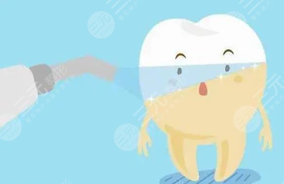 超聲波潔牙要多少錢(qián)一次?