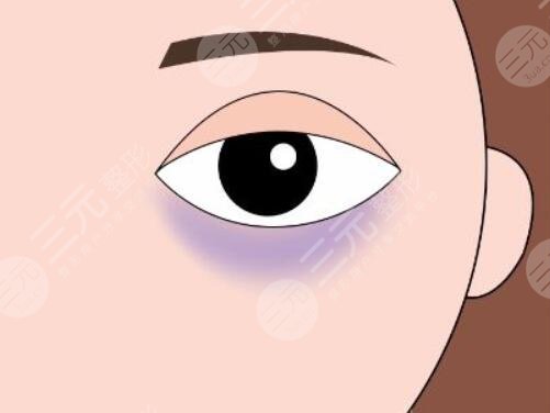 有黑眼圈是怎么回事？先天遺傳、后天因素導(dǎo)致的原因分析，該怎么有效避免？