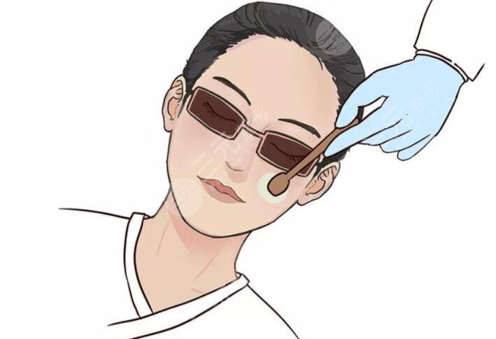 鐳射激光嫩膚多少錢做一次2023？鐳射激光嫩膚原理及預(yù)后效果是怎樣的？