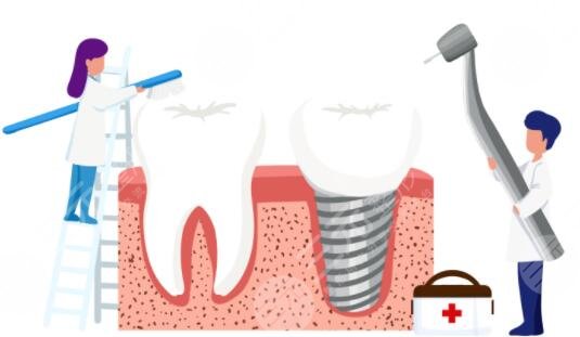種植牙齒多少錢(qián)？