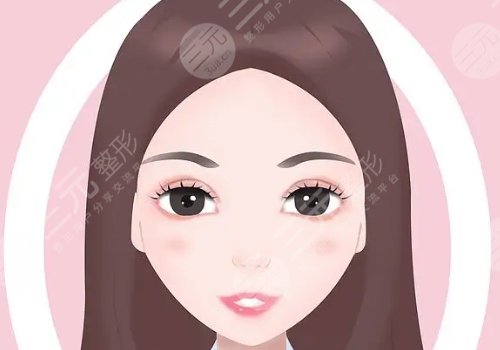 蘋果肌太大怎么改良？