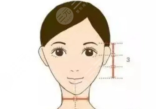 蘋果肌太大怎么改良？