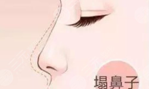 奧美定隆鼻有什么副作用？