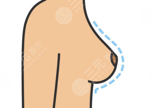 奧美定取出手術(shù)后要注意些什么？