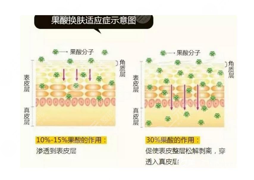 珍珠粉能美白皮膚嗎?