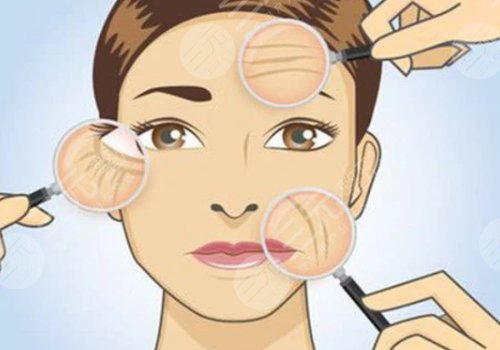 如何去除抬頭紋？