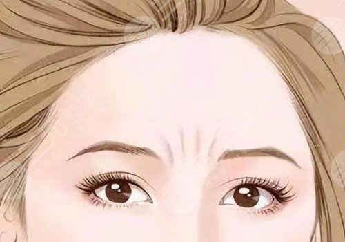 如何去除抬頭紋？