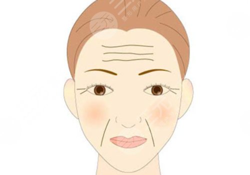 如何去除抬頭紋？