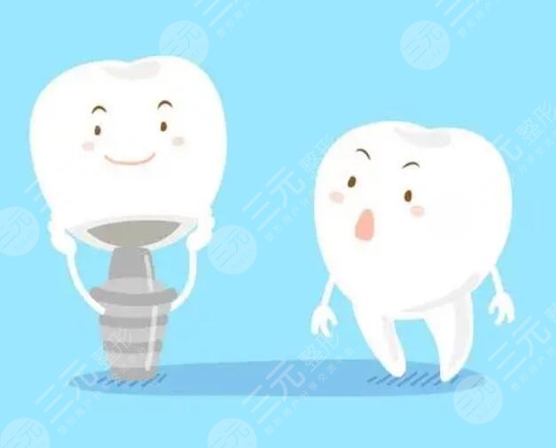 種牙材質都有哪些品牌好?