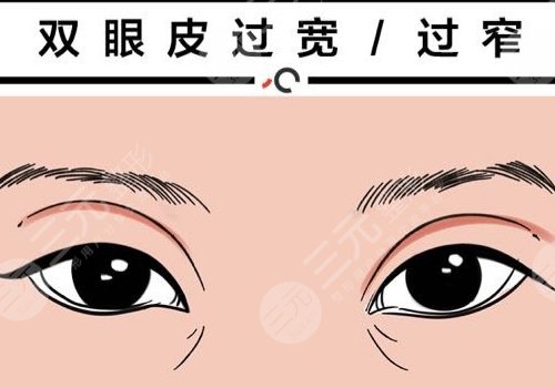 雙眼皮修復(fù)大概多少錢(qián)呢?