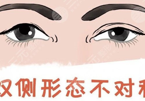 雙眼皮修復(fù)大概多少錢(qián)呢?