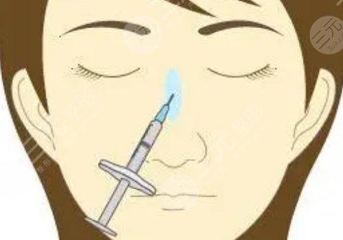 愛貝芙隆鼻會(huì)變寬嗎