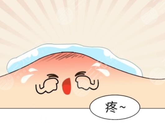 痤瘡的緩解價(jià)格是多少2023?