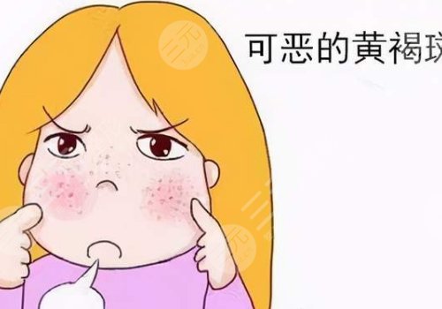 去除黃褐斑價格是多少？