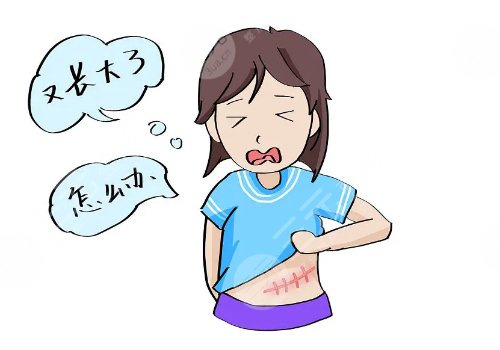 激光去疤痕需要幾次才能徹底消除？