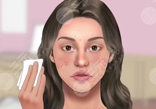 去黑頭收縮毛孔好的方法有哪些？