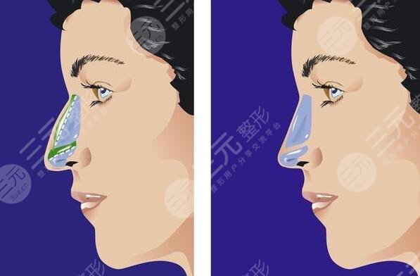 俞積貴醫(yī)生擅長(zhǎng)項(xiàng)目介紹