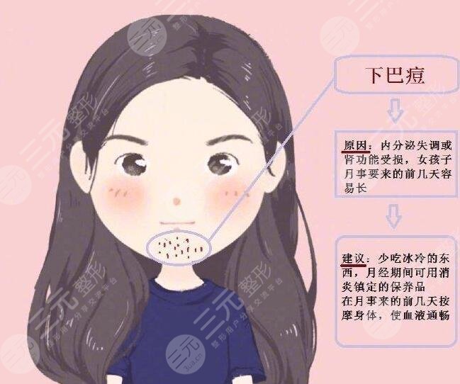 激光祛痘需要多長時間能徹底恢復好？需要緩解幾次？療程是多久？