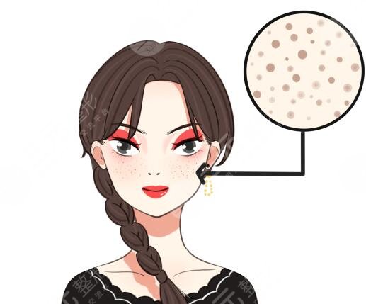 強(qiáng)光祛斑