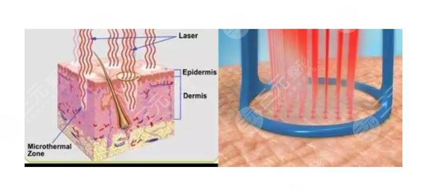 眼袋是怎么產(chǎn)生的？如何消除眼袋？