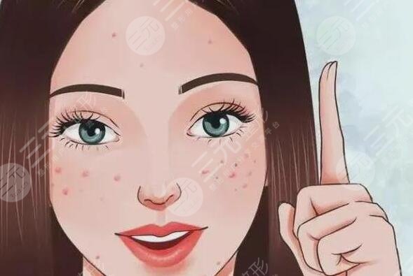 緩解青春痘費用大概多少錢？哪些方法有效且安全可靠？