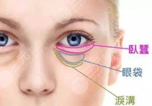 眼袋怎么消除？