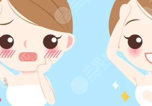 激光脫毛和冰點脫毛有什么區(qū)別？