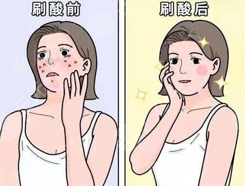 果酸換膚的副作用和危害多久會(huì)顯現(xiàn)出來?