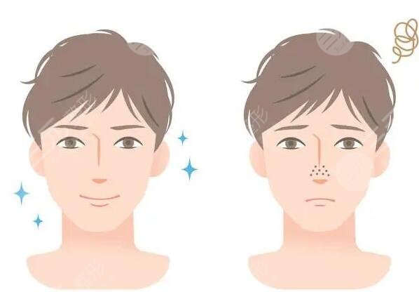 男士皮膚美白的方法和技巧有哪些?擁有健康男子氣概膚色~