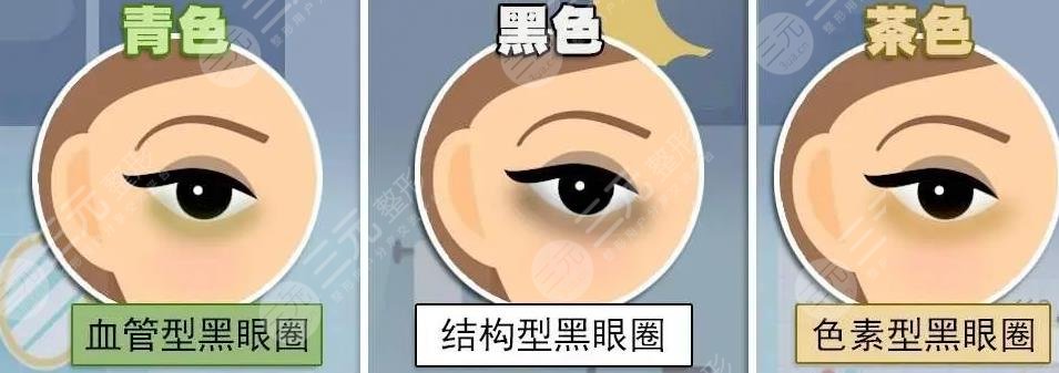 有了黑眼圈怎么消除？